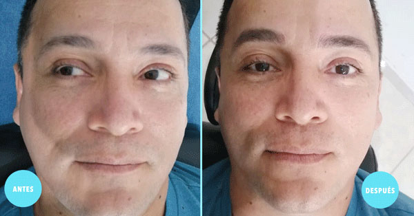 Microblading de Cejas en Colima | Para Hombre